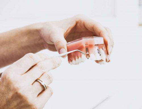 Mikor kerülhet sor egy implantátum beültetésére?